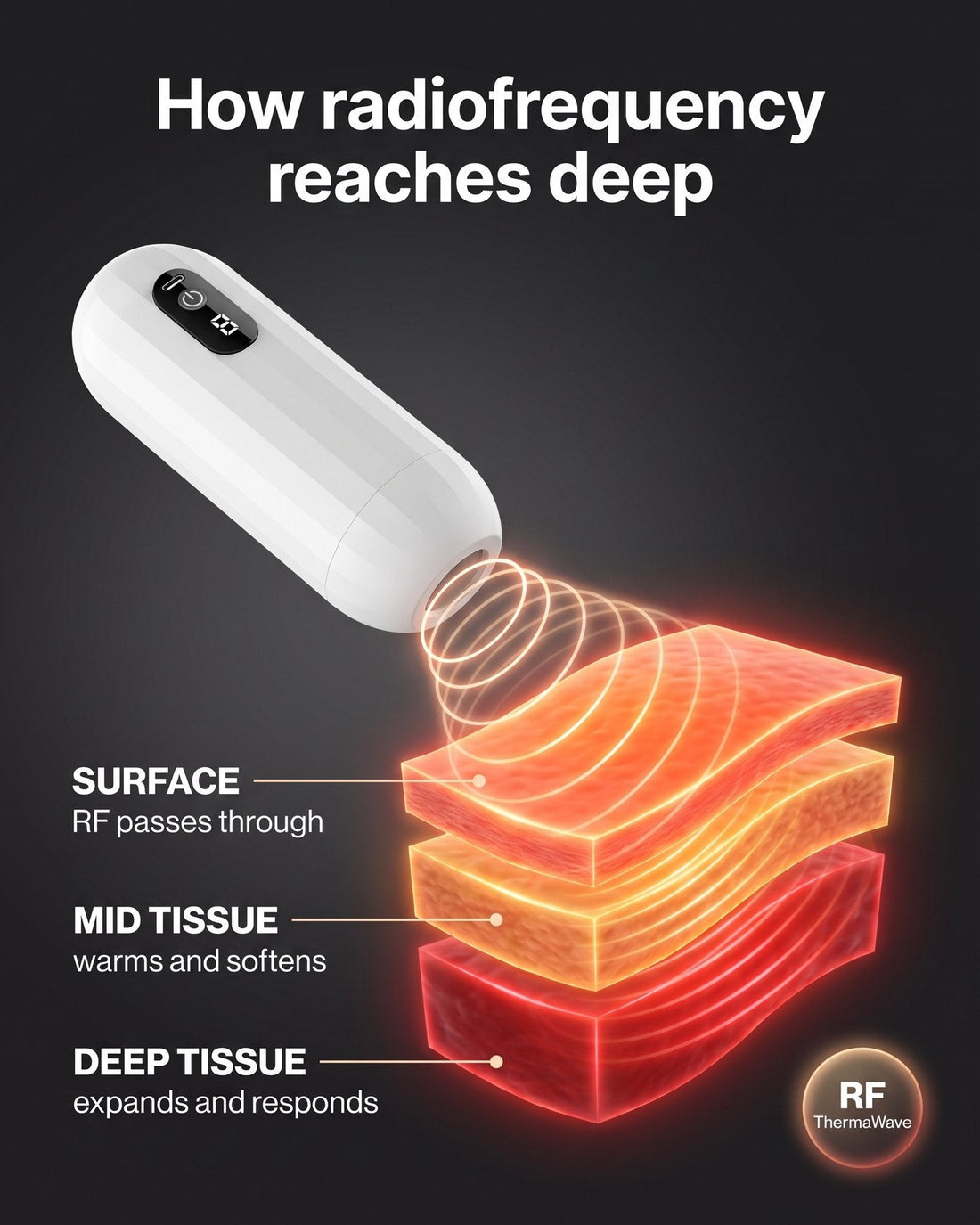 How radiofrequency reaches deep: surface, mid and deep tissue